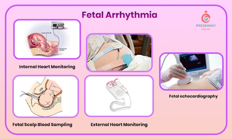 Fetal Arrhythmia Treatment