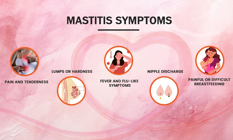 Mastitis Symptoms