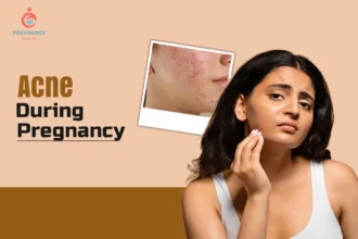 Acne During Pregnancy: Causes, Symptoms, Safe Treatments, and Skincare Tips for Moms-to-Be